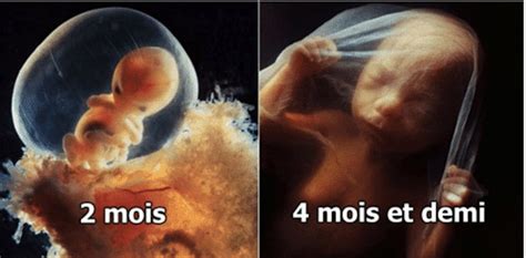 Lévolution Dun Foetus Dans Le Ventre De Sa Mère En 21 Photos