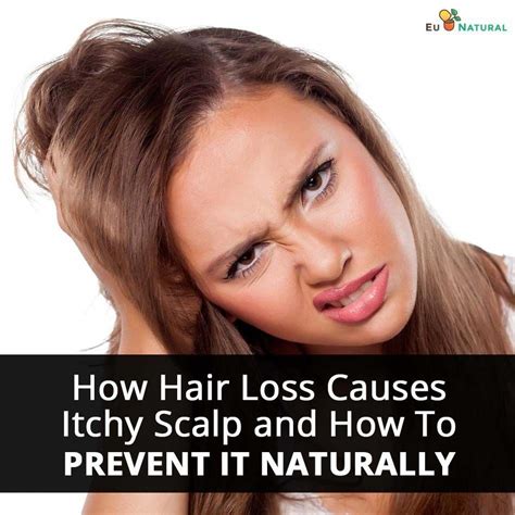 How Hair Loss Causes Itchy Scalp And How To Prevent It Naturally Anti