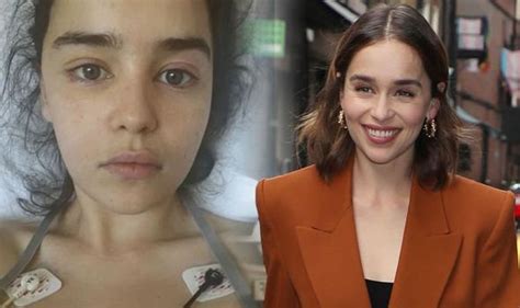 Emilia Clarke Health The Got Actress Suffered Two Brain Aneurysms