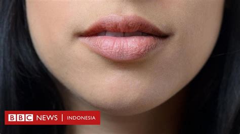 Nasib Orang Orang Yang Tidak Bisa Tersenyum Bbc News Indonesia