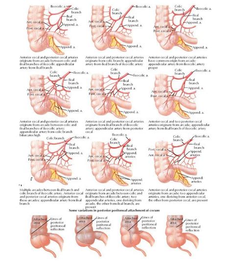 Variations In Arterial Supply To Cecum And Posterior Peritoneal