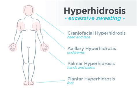 Types Of Hyperhidrosis Medizzy