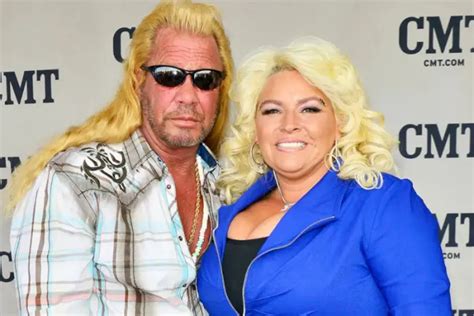 Beth Chapman Weight Loss Surgery Before And After 2024