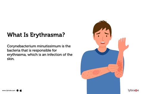 Erythrasma Causes Symptoms Treatment And Cost