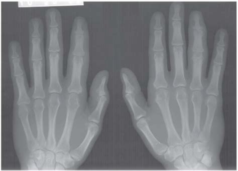 Hand And Wrist Radiology Key