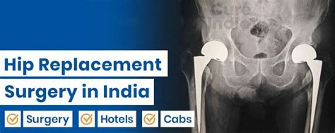 Hip Replacement Surgery In India Types Of Hip Replacement Recovery Time