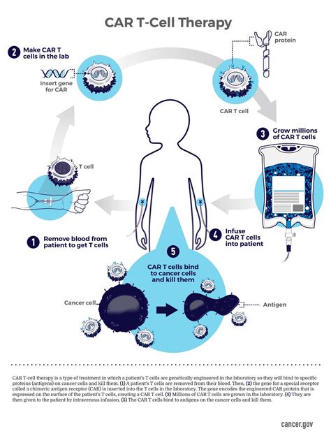 Car T Cell Therapy Infographic National Cancer Institute