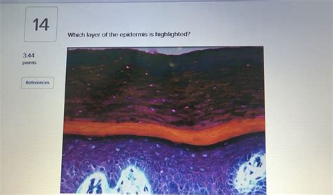 Solved 14 Which Layer Of The Epidermis Is Highlighted 344