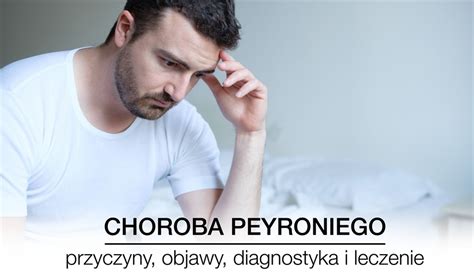 Choroba Peyroniego Przyczyny Objawy I Leczenie Kowalezdrowiapl Porn Sex Picture