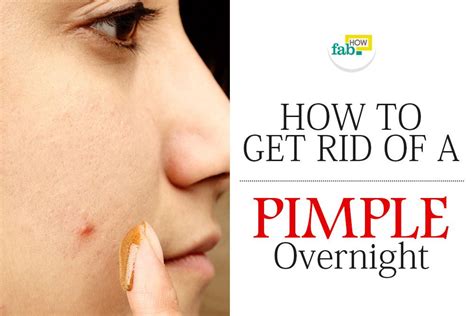 How To Get Rid Of A Pimple Overnight Fab How