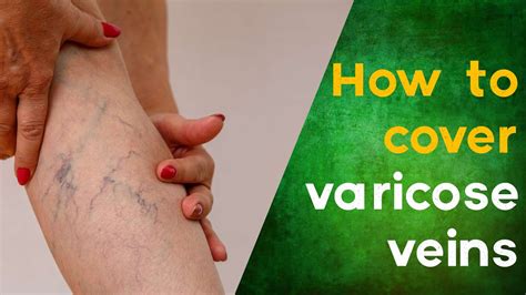 Beauty Secrets How To Cover Varicose Veins With Make Up Beauty Tips Youtube