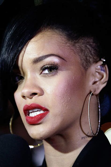 Rihanna Celebs With Bad Skin Us Weekly