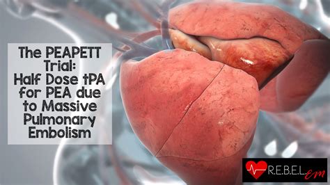 Salim R Rezaie On Twitter The Peapett Trial Half Dose Tpa For Pea