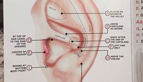 acupuncture ear seeds for weight loss