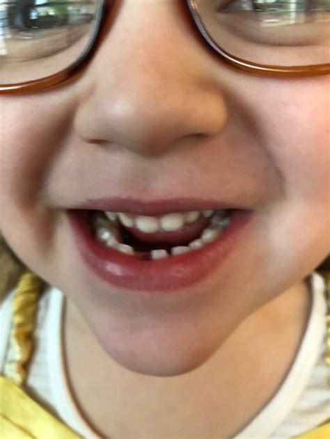 Tessa Lost Her First Tooth The Busy Banuelos