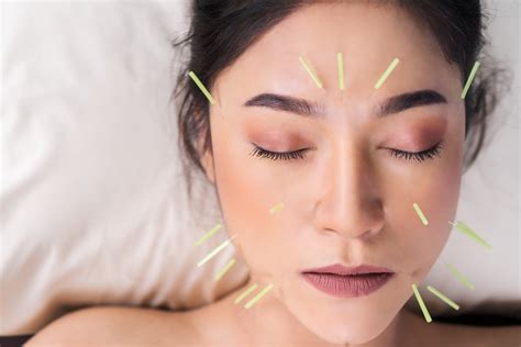 Cosmetic Facial Acupuncture At Natural Medicine Of Seattle