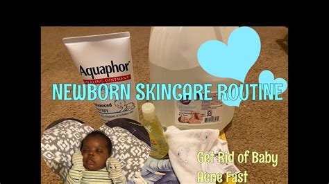 How To Get Rid Of Baby Acne Newborn Skincare Routine🧼 Youtube