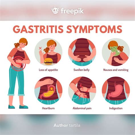 Conjunto De Síntomas De Gastritis Premium Vector Freepik Vector