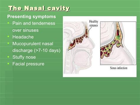 This commonly includes nasal obstruction, sore throat, tonsillitis, pharyngitis, laryngitis, sinusitis, otitis media. Upper Respiratory Tract Infection