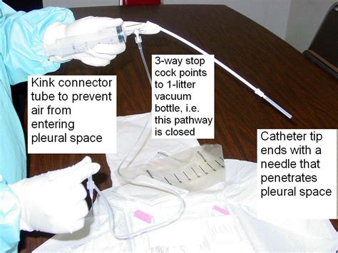 Clinical Notes Thoracentesis A Step By Step Procedure Guide With Photos