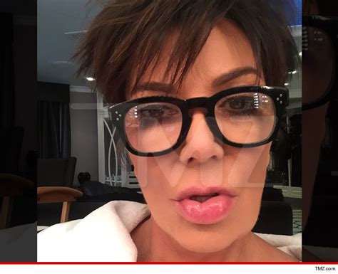 Kris Jenner Heres My Proof A Spider Made Gave Me A Fat Lip
