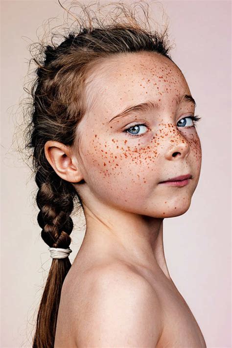 Striking Portraits Of Freckled People By British Photographer Reckon Talk
