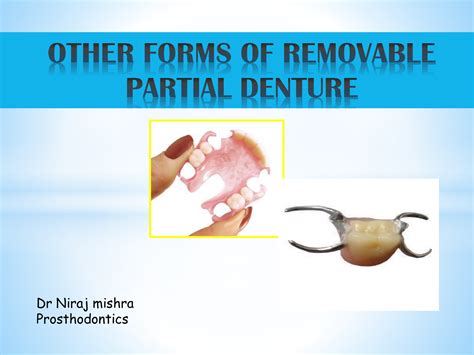 We did not find results for: other forms of removable partial denture ppt