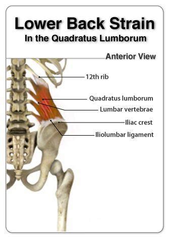 Low back pain refers to pain that you feel in your lower back. Quadratus Lumborum Pain | El Paso, TX Doctor Of Chiropractic