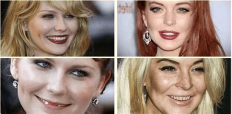 Muchas celebridades transforman su look con carillas dentales, siempre con la intención de mejorar su sonrisa. Famosos que utilizan las carillas de composite en sus ...