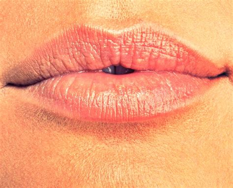 Crusty Lips