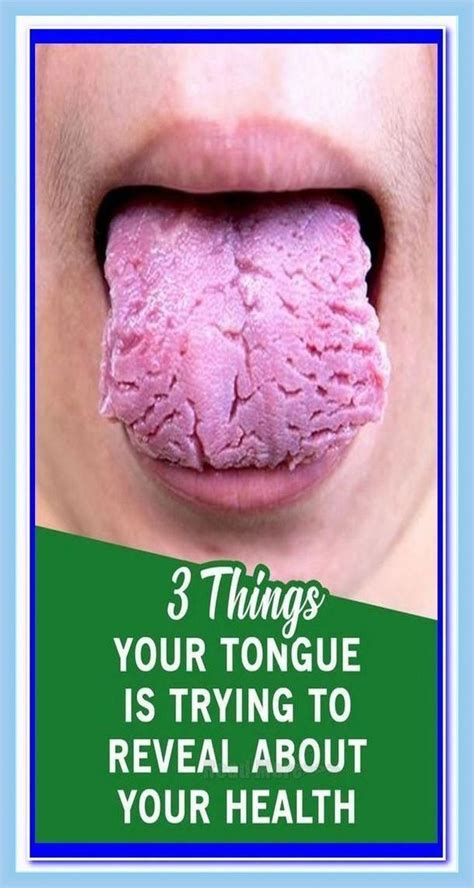 What Your Tongue Is Trying To Tell You About Your Health By Adeu