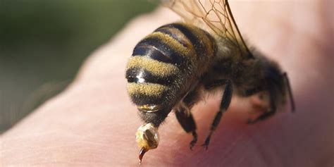 Melunakkan plastisin dapat dilakukan dengan cara. Mengobati Sengatan Lebah Dapat Dilakukan dengan Cara Ini
