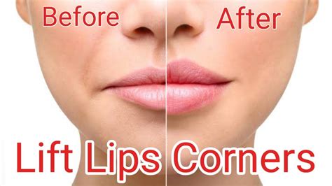 Lip Corner Lift Exercise Lift Lip Corners Naturally Fix Droopy Mouth