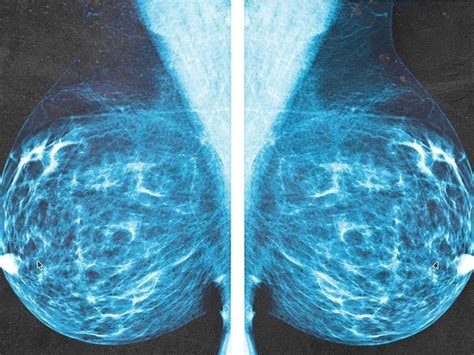 Breast Anatomy Functions And How To Check For Breast Cancer 2023