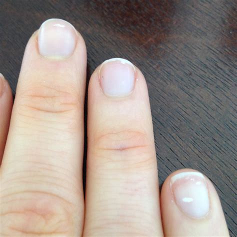 List Of White Spots On Fingernails Deficiency Inya Head
