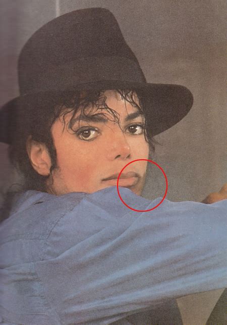 The Vitiligo Proof Michael Jackson Photo 32272055 Fanpop