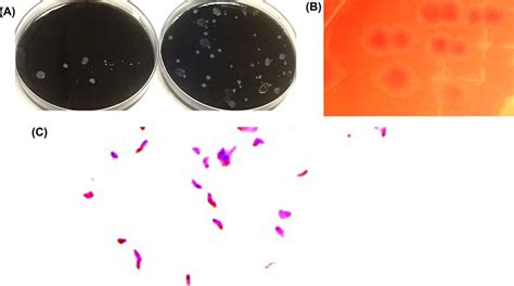Colonies Of C Jejuni Colonies On Campylobacter Blood Free Selective