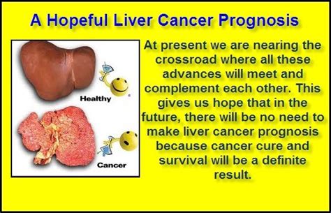 10 Best Liver Cancer Life Expectancy Images On Pinterest