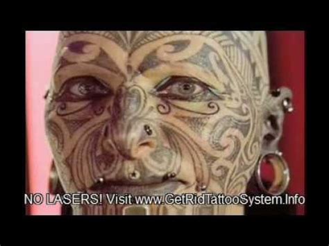 Salabrasion salabrasion is a tattoo removal process that requires the use of tap water, plain table salt, and an abrasive device; At Home Natural Tattoo Removal Remedies (Say NO to Lasers ...