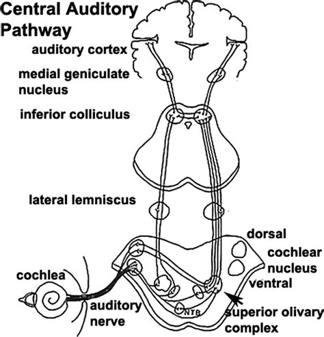 The Functional Anatomy Of Central Auditory Processing Practical Neurology