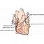 Chapter 2 – Inferior Wall Myocardial Infarction  Thoracic Key