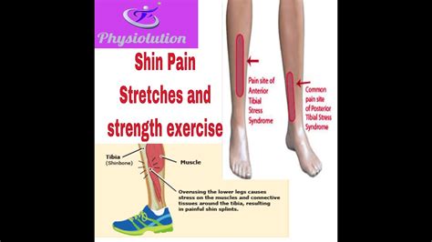 Six Simple Shin Pain Relief Stretches And Strengthening Exercises