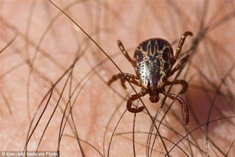 Oklahoma Woman Has All Of Her Limbs Amputated After Tick Bite