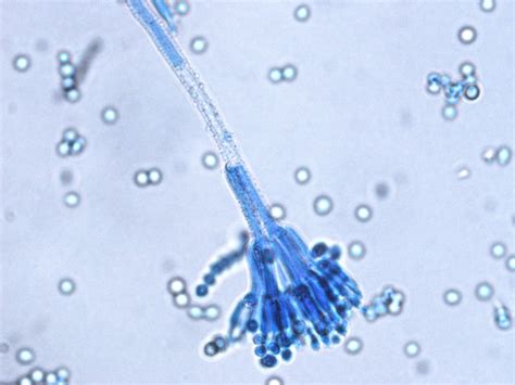 Penicillium Microscope