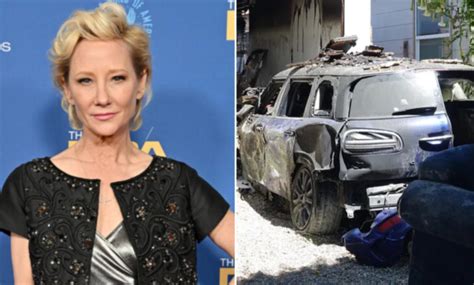 Anne Heche Six Days Seven Nights Actress Severely Burned In Car Crash
