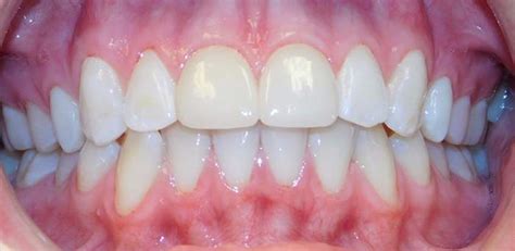Blue dental studio in miami, florida provides quality dental care to all its patients. Gallery - Dental Implant Studio