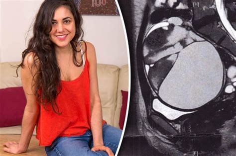 Sex Helps London Woman Discover Bowling Ball Sized Cancerous Tumour