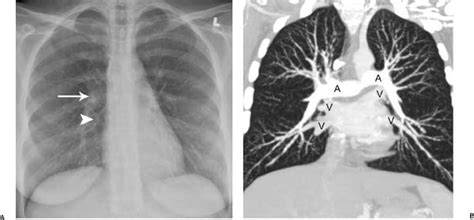 Anatomy | Radiology Key