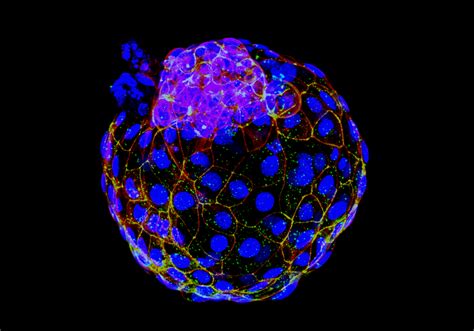 Human Blastocyst Like Structures Made In The Lab The Scientist Magazine
