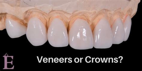 Check spelling or type a new query. Dental Implants Have Many Benefits - Learn Why They May be ...